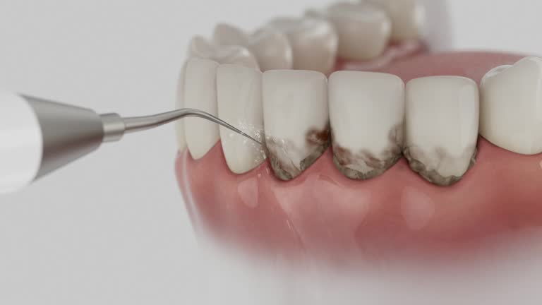 Trusted Teeth Cleaning And Checkup service in Wright, FL - Dentist Open Now